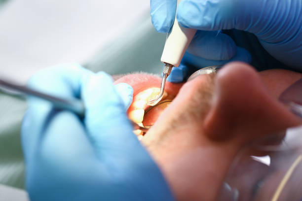 Best Emergency Dental Care for Abscessed Tooth in Robins, IA